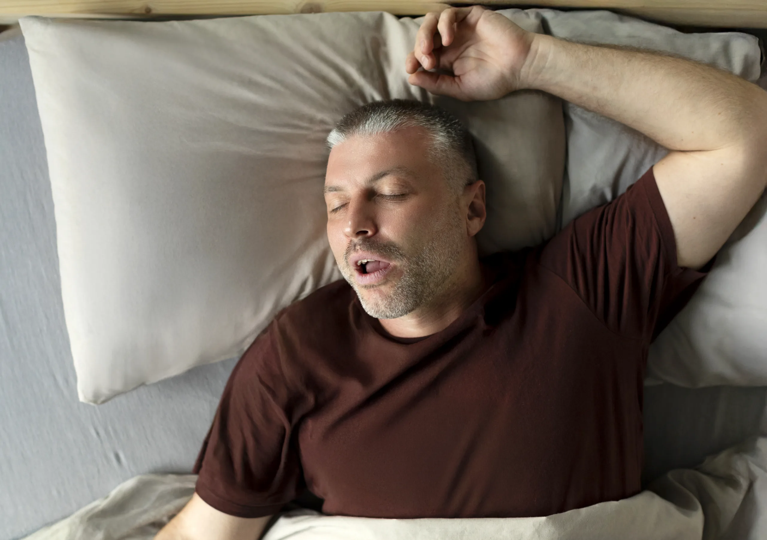 OBSTRUCTIVE SLEEP APNOEA (OSA)